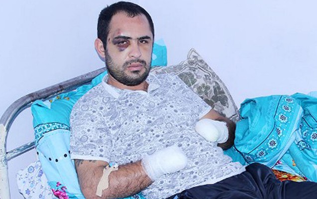 26-yasli-gencin-her-iki-qolunu-vehabiler-kesib